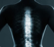 Human backbone in x-ray