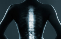 Human backbone in x-ray