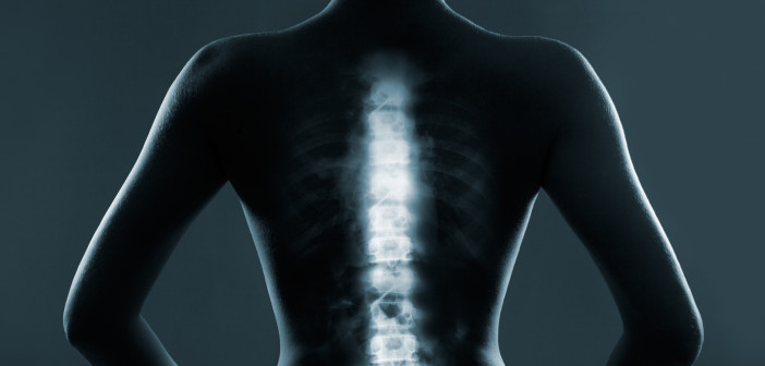 Human backbone in x-ray